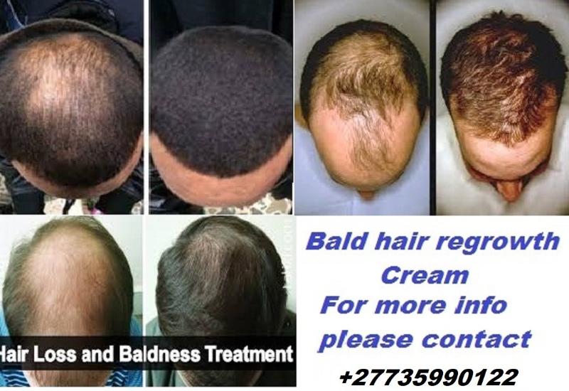 Bald head hair recovery cream +27735990122