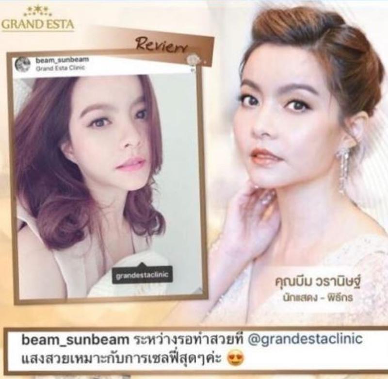 Best Cosmetic Surgery in Thailand